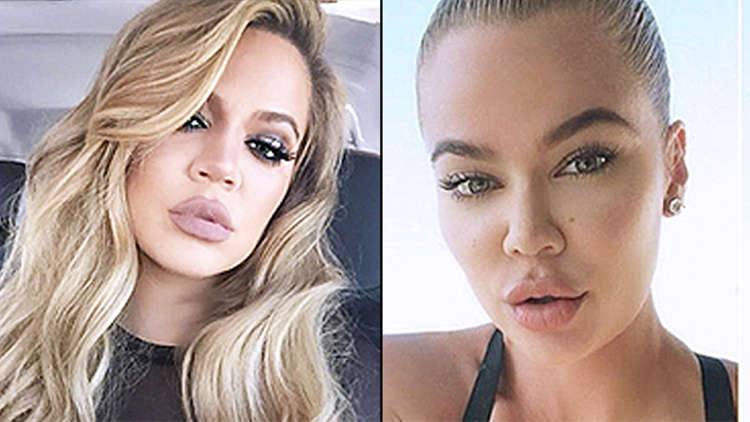 Khloe K turns off comments after being trolled for rumored lip filler!