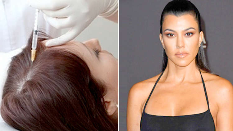 Kourtney Kardashian gets plasma injections to fix bald spot on her head