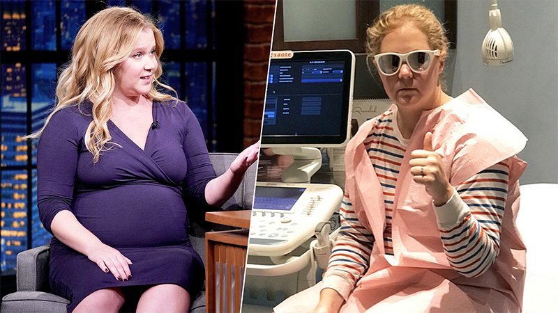Amy Schumer Recalls Terrifying Moment She Faced During Pregnancy