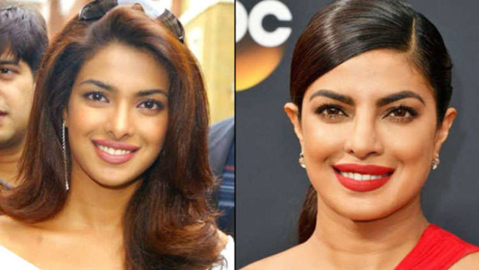 Priyanka Chopra reveals details about her plastic surgery