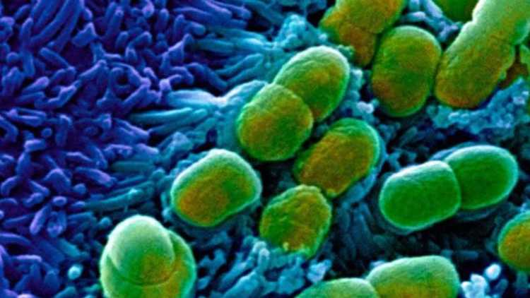AI discovers antibiotic that can fight drug-resistant diseases