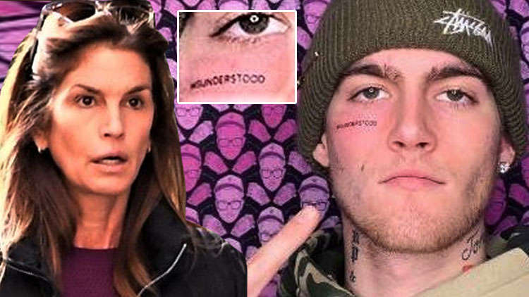 Presley Gerber removed his misunderstood face tattoo