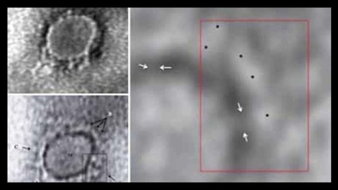 First images from India of virus causing COVID-19 captured by scientists