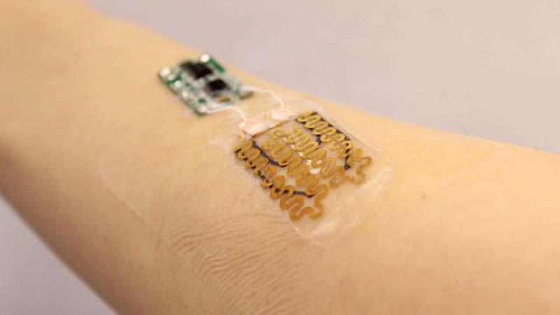 Scientists create 'smart' bandages to heal chronic wounds