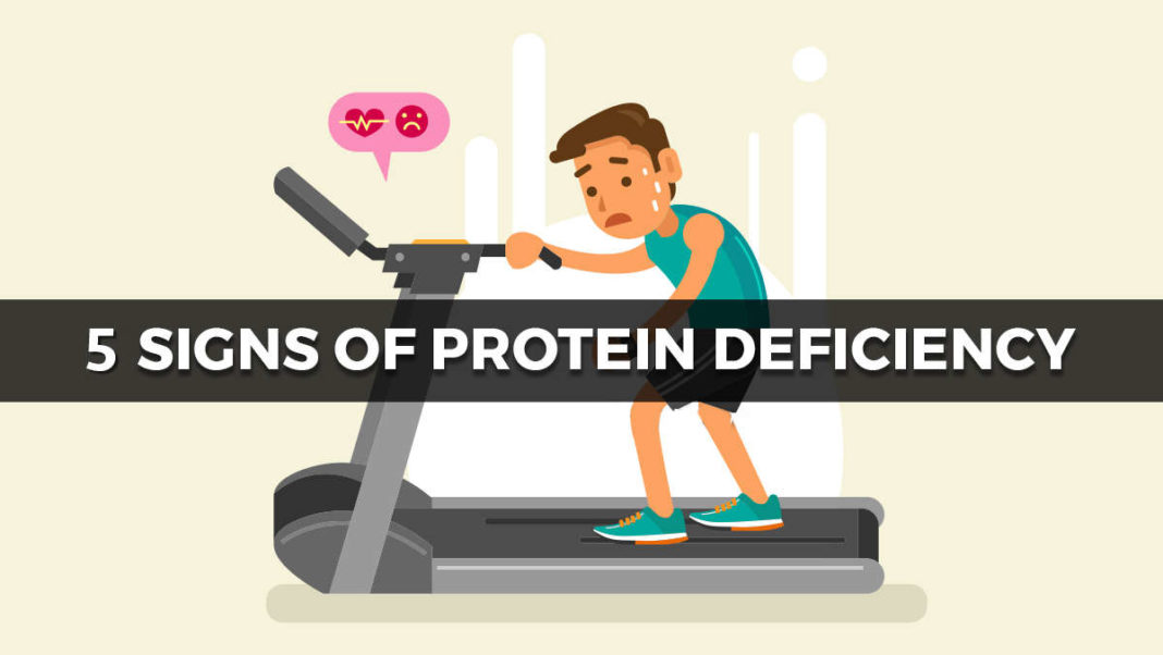 5 Signs That Prove You're Protein Deficient