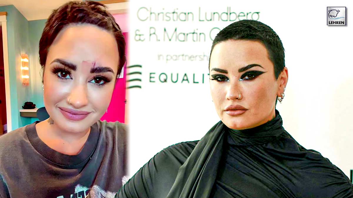 Demi Lovato Suffers Facial Injury, Undergoes Stitches