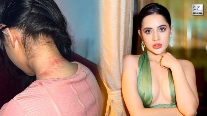What's The Truth Behind Urfi Javed's Viral 'Suicide' Pic?