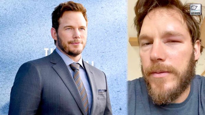 Chris Pratt Reveals He Was Stung By A Bee In His Eye