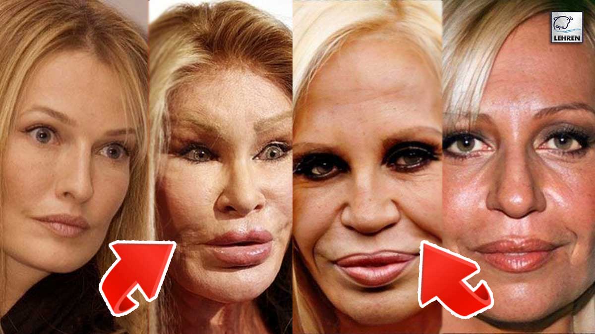 celebrities before and after plastic surgery gone wrong