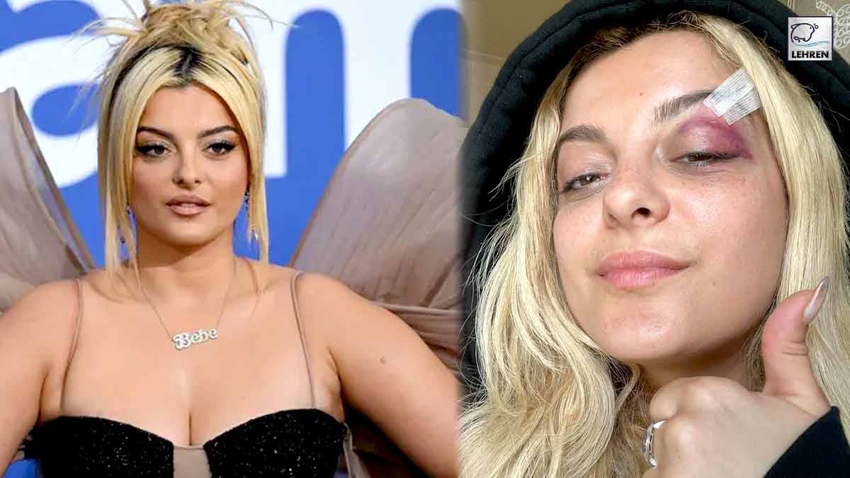 bebe rexha gets hit in face by cellphone