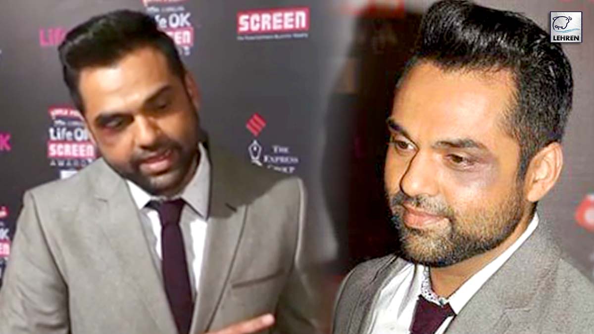 once abhay deol walked the red carpet with black eye