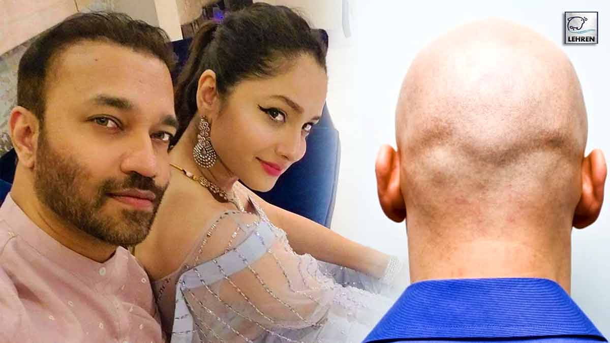 is ankita lokhande's husband vicky jain bald